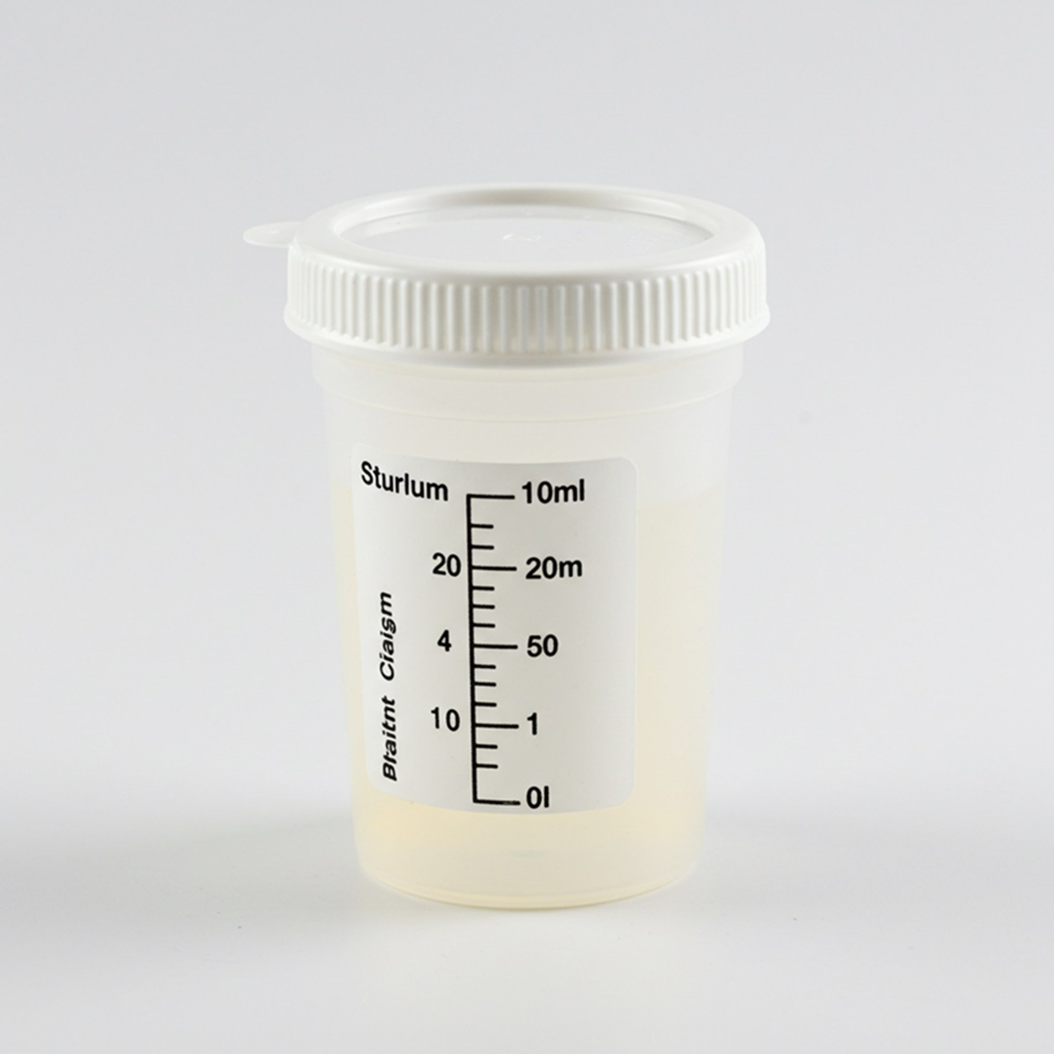 Schiuma bianca nelle urine, cosa significa? Immagine per l'articolo: Schiuma bianca nelle urine, cosa significa?